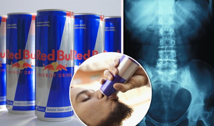 Red Bull Effects On Your Body Up To 24 Hours After Drinking