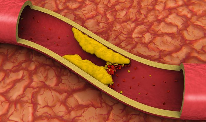 Best Supplements For Cholesterol Fish Oil Supplements Keeps Cholesterol Level Healthy Express Co Uk