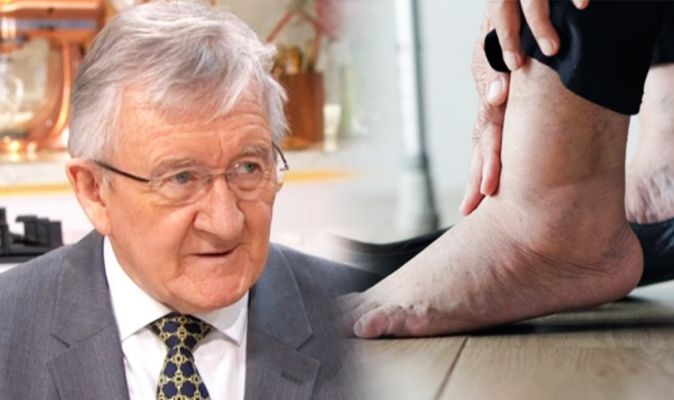 Swollen Ankles Could Be A Sign Of Oedema Dr Chris Recommends Treatment On This Morning Express Co Uk