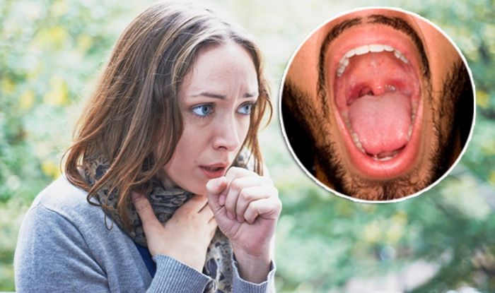 Most Sore Throats Are Not Caused By Illness Express Co Uk