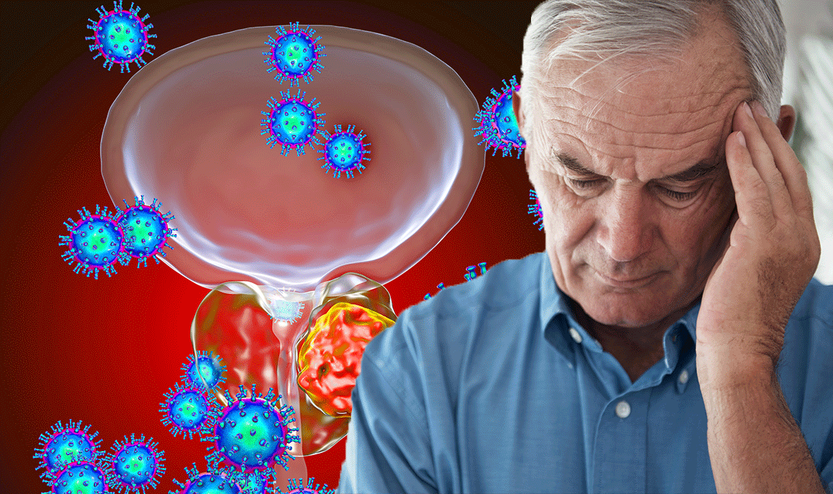 Prostate Cancer Symptoms Experiencing Bone Pain Could Signal The