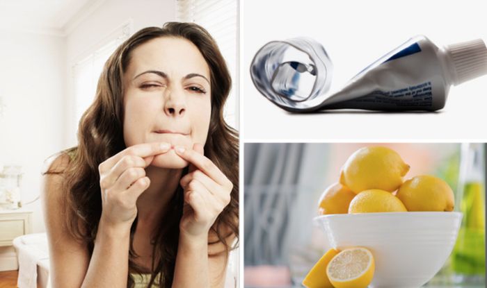 Spot Of Bother Get Rid Of Acne In One Day Doing This Trick Express Co Uk