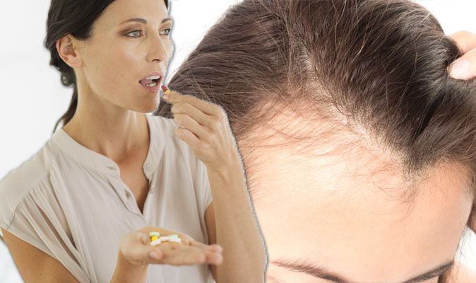 Best Supplements For Hair Loss Add Vitamin D To Diet For