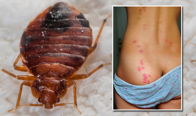 Bed Bug Bites Five Signs You Ve Been Bitten And How To Get Rid Of An Infestation Express Co Uk